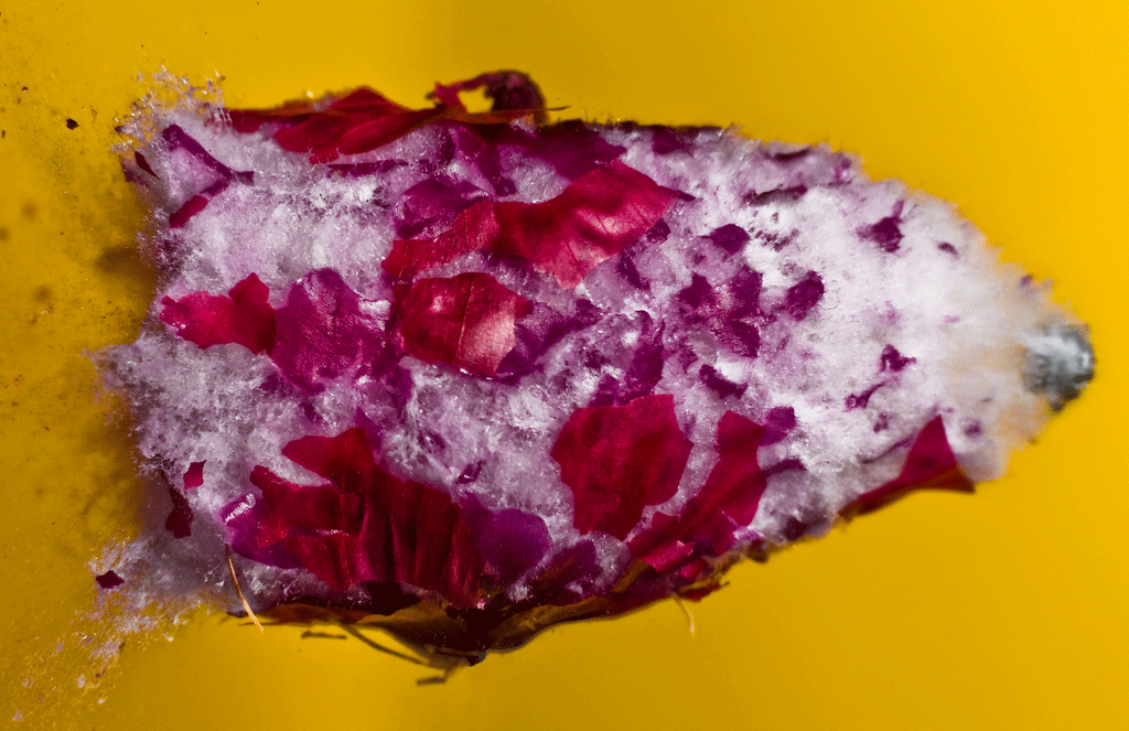 Onion Disorder Alan Sailer